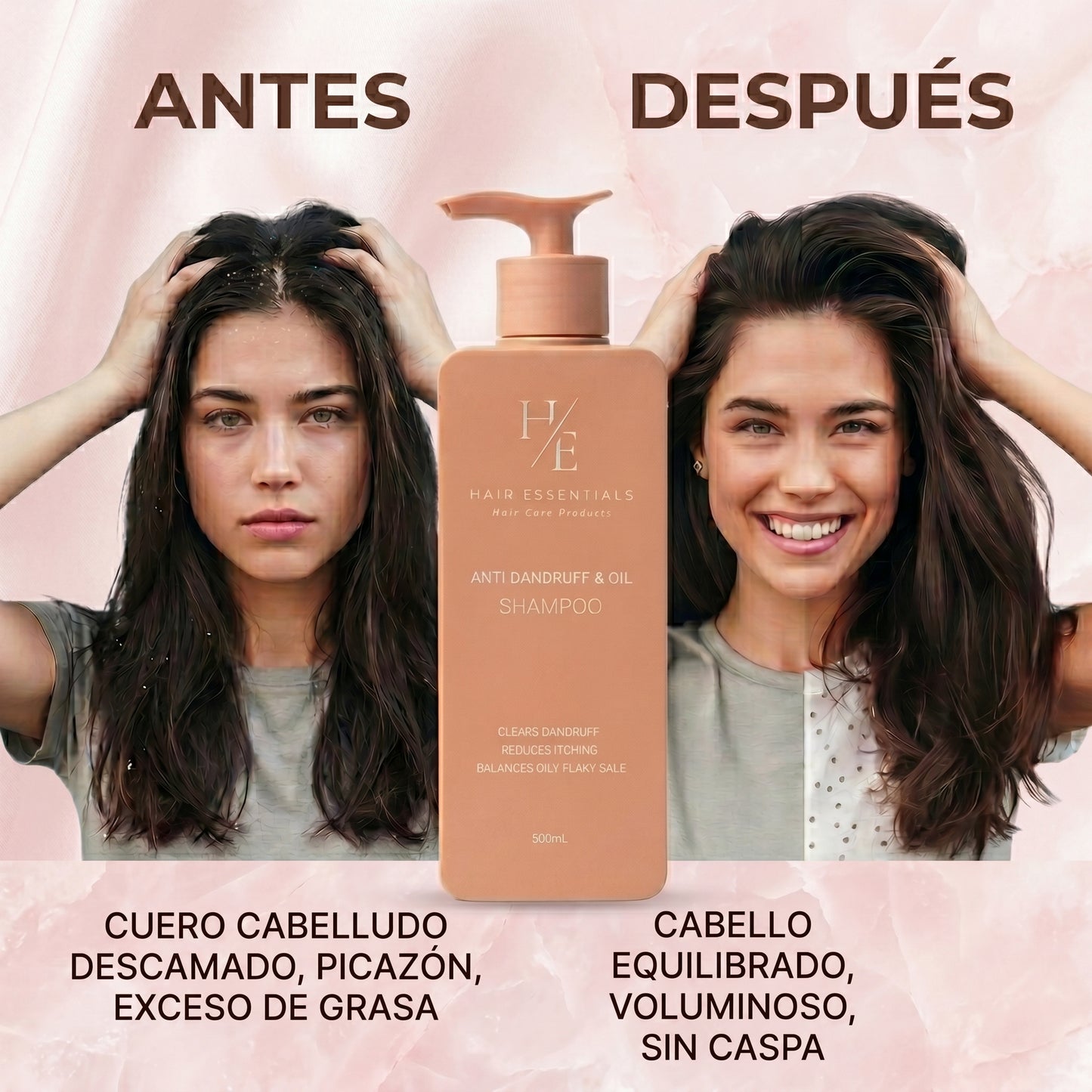 Champú Anticaspa y Control de Grasa Hair Essentials